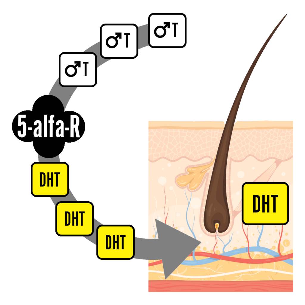 Przedstawienie procesu podczas, którego Enzym 5-alfa-reduktaza zamienia testosteron w dihydrotestosteron (DHT